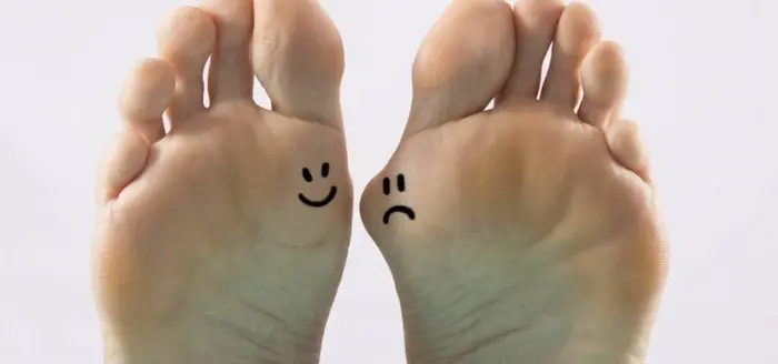 قوز شست پا در پای بانوی میانسال 646546410